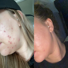 Load image into Gallery viewer, Glow Up Essentials Kit